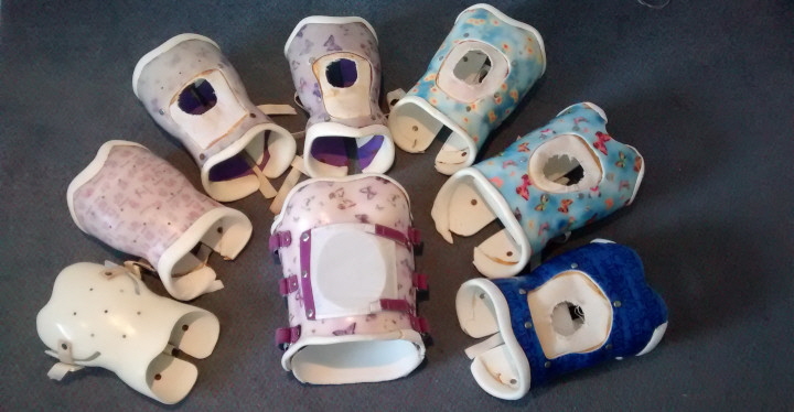 Collection of Lizzie's spinal braces